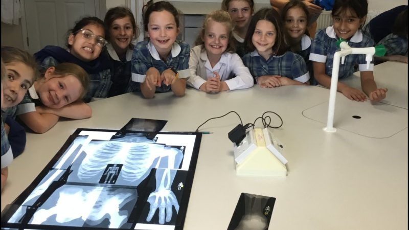 Year 3 Science - Bones